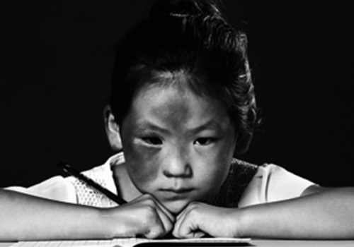 为什么说靠药品去除不了胎记