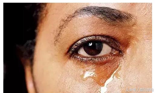 新冠红眼病有什么症状,羔羊红眼病的症状及治疗