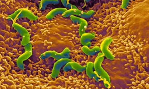 如果胃不好请喝这三种茶,什么茶适合胃不好的人长期喝