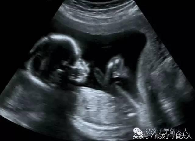 孕妈妈每周做一次b超,准妈妈孕期需要做哪些检查