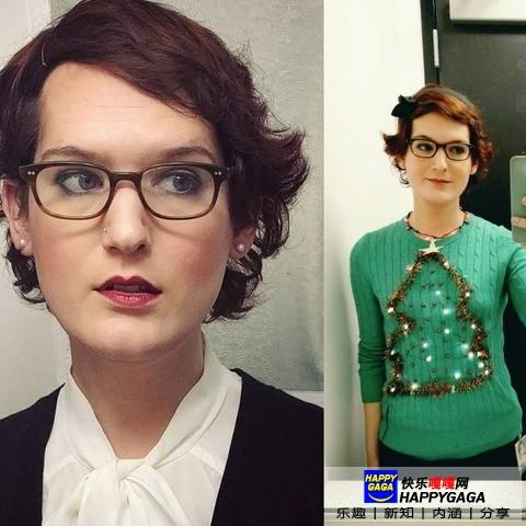 雌激素治脱发,雄性激素脱发补充雌性激素有用吗