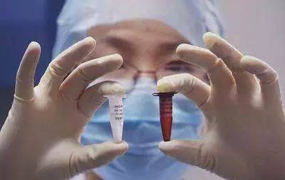 禽流感没有疫情的地区该如何防护,禽流感的主要应对措施