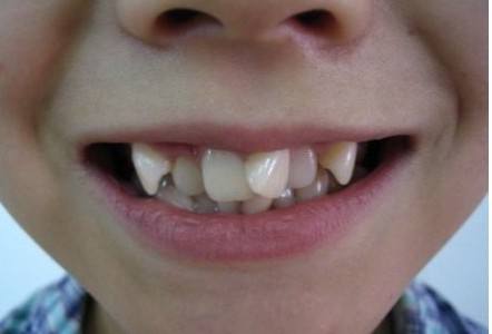 宝宝为什么喜欢张大嘴笑,小宝宝为啥抿着嘴笑