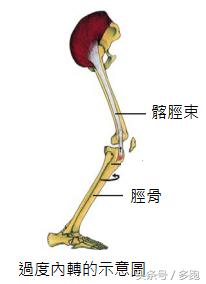 跑者攻略：告别恼人的ITBS