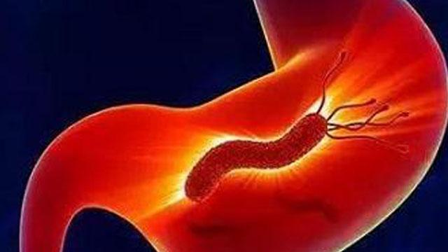 塞来昔布治疗萎缩性胃炎怎样用药,浅表性胃炎萎缩性胃炎需要用药吗