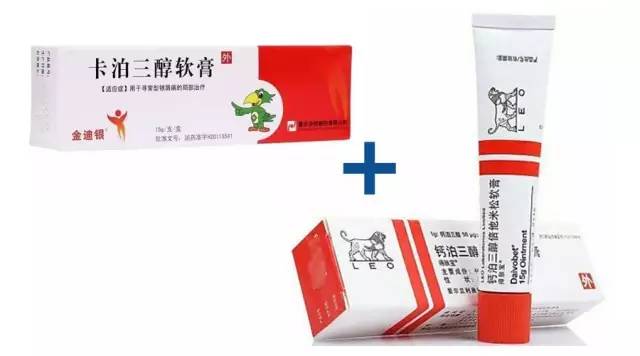 治疗银屑病最新的生物制剂,推荐银屑病特效药膏