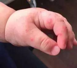 四岁女孩手指被截,一个女生下意识的小动作