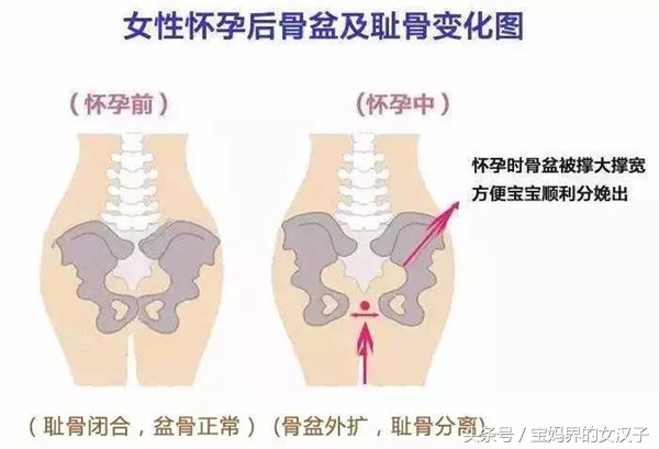 孕晚期耻骨痛影响顺产吗,孕晚期没有耻骨痛会影响顺产吗