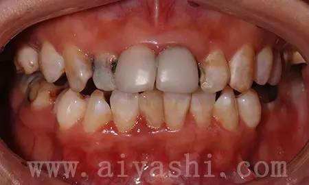 我们的牙齿是怎么来的,我们的牙齿是哪来的