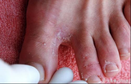 图解成年人常见的皮肤问题