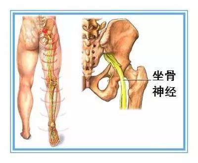 90%的腰痛都没必要拍片,腿疼看医生视频