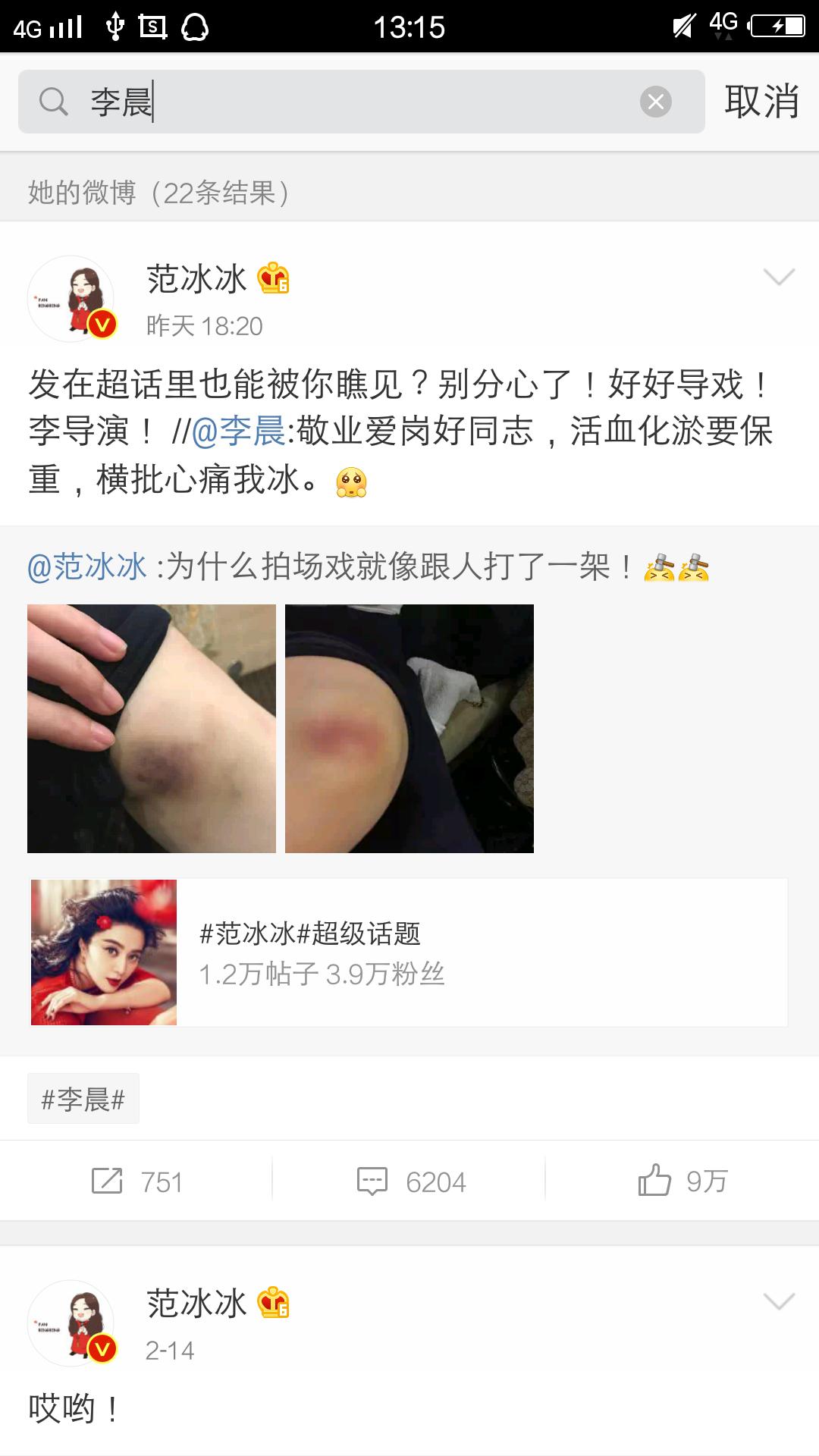 范冰冰拍戏受伤小腿淤青，李晨直呼“心痛我冰”