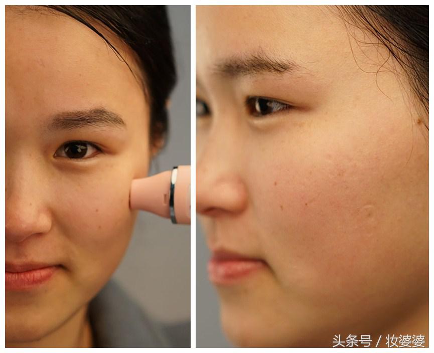 黑金软膜美白淡斑面膜测评,黑面膜美白补水淡斑测评