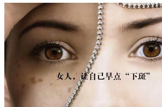 祛斑效果最好的祛斑方法,祛斑的有效方法红霉素软膏祛斑