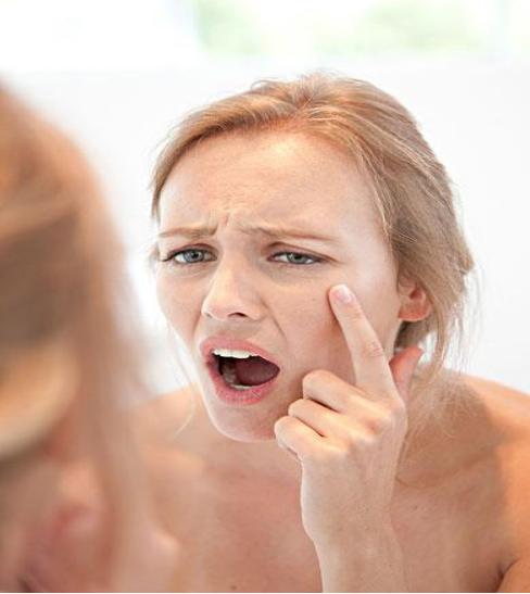 长斑长痘了用什么产品好,长痘长斑怎么调理