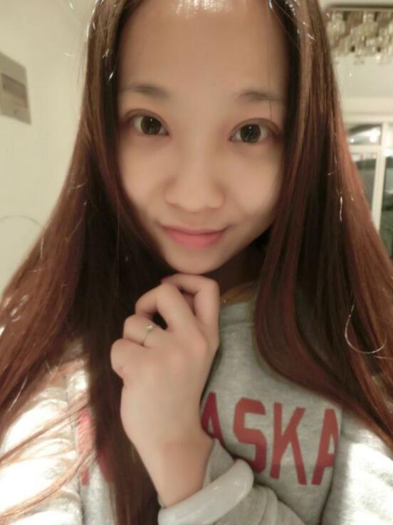 完美的埋线双眼皮,完美双眼皮