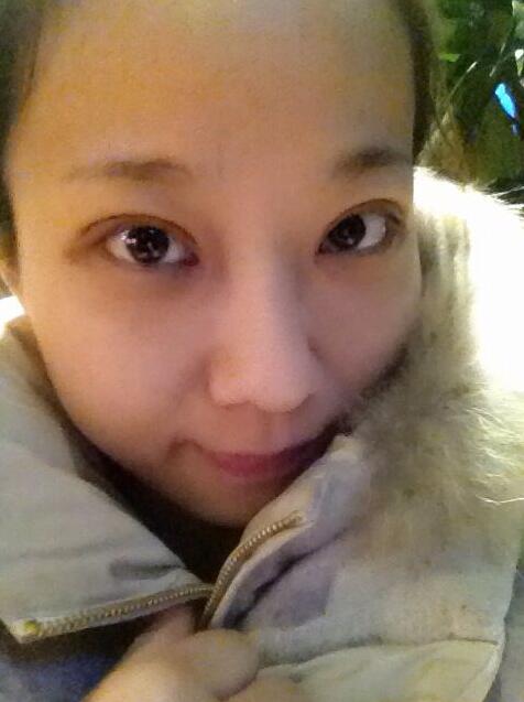 完美的埋线双眼皮,完美双眼皮