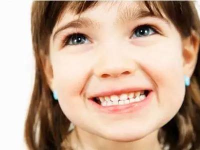 儿童龋齿别大意,有问题要早诊治