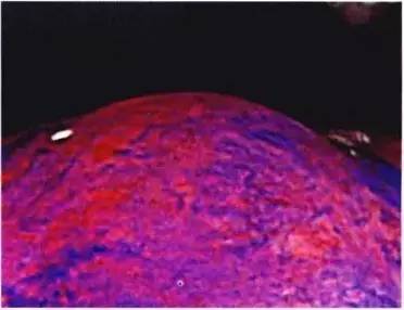 普通内镜与Pitpattern分型（多图详解）