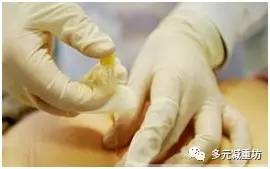 中医埋线减重,中医埋线真的能增重吗