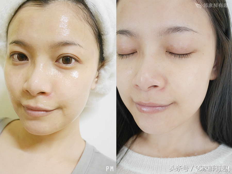 消除皮肤泛红,消除敏感肌角质层薄