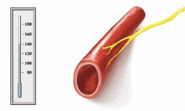 a型主动脉夹层是什么原因引起的,主动脉夹层b型支架对寿命的影响
