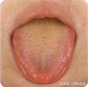 舌头舌诊,如何快速辨舌诊