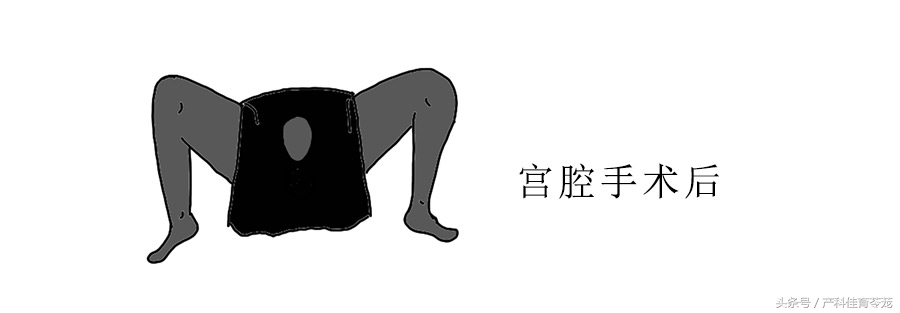 治疗盆腔炎最好最快是用什么药,盆腔炎能不能彻底治好