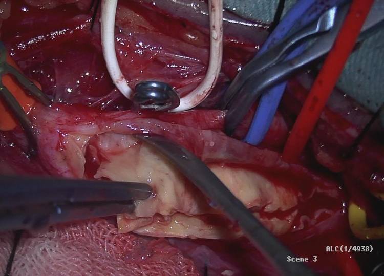 改善脑供血不足的药有哪些,脑供血不足常敲打3个穴位