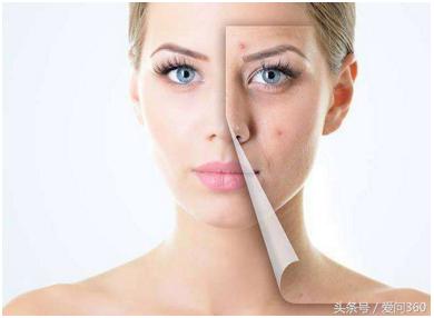 中药祛湿气是怎么把湿气排出的,排出湿气功能最强的19种食物