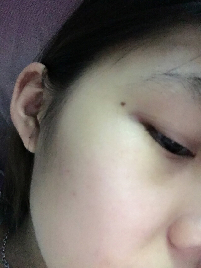 嘴角右边有痣代表什么含义女人,手指各个地方长痣的不同含义