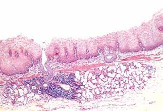 内镜做病理分析大概多久,作为一个医生太感性怎么办