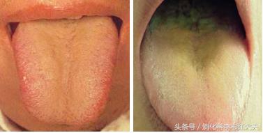 你有口臭怎么解决,你有口臭说明什么