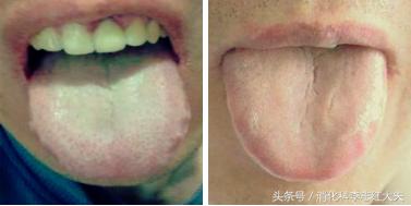 你有口臭怎么解决,你有口臭说明什么