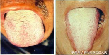 你有口臭怎么解决,你有口臭说明什么