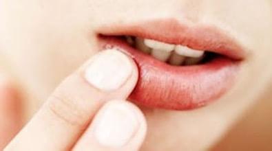 嘴巴上起泡是什么原因,嘴巴里起泡是什么病的前兆