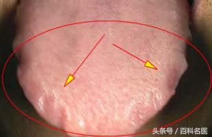 人身体怎样排湿毒,养五脏排五毒