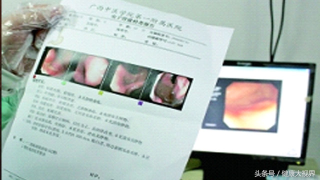 萎缩胃炎肠化看中医好吗 (浅表性非萎缩性胃炎胆汁反流肠化)