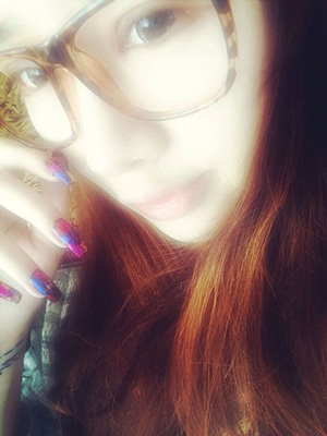 双眼皮手术后修复视频,双眼皮手术恢复记录视频