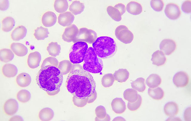 一觉醒来浑身是汗应该怎么调理,一觉醒来一身汗是咋回事