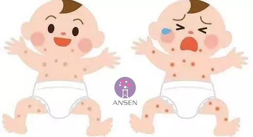 宝宝湿疹的物理治疗方法有,宝宝急性湿疹会自动好吗