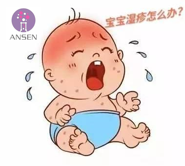 婴儿湿疹克星一览表,湿疹不用怕3个小妙招轻松应对