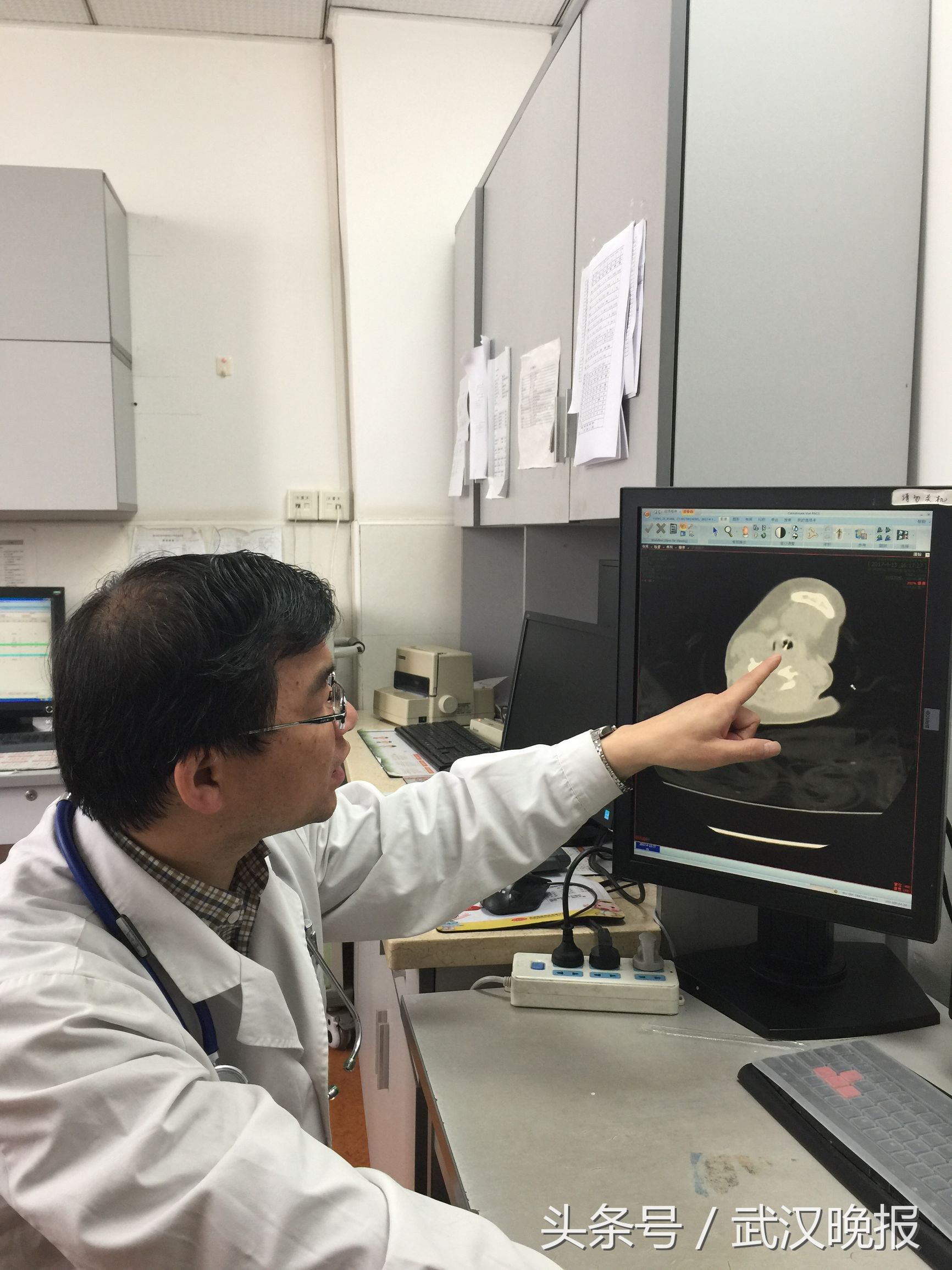 宝宝反复低烧咳嗽可以打针吗,咳嗽发烧打了5天阿奇不见好