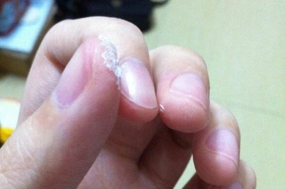 502胶水粘久了怎么溶解去除,502胶粘得太紧如何整掉