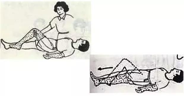 脑梗死锻炼可以恢复双腿无力么,脑梗死运动障碍