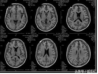 右上腹不适和眼睛发黄,右上腹不适一年多了