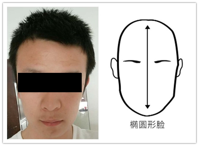 男生头发两边太炸怎么办,男生发型两边太炸怎么办