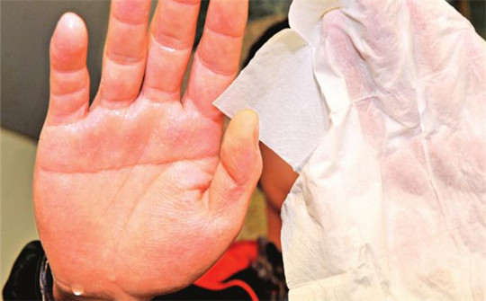 手心出汗怎样调理最好,女性手心脚心出汗怎么调理