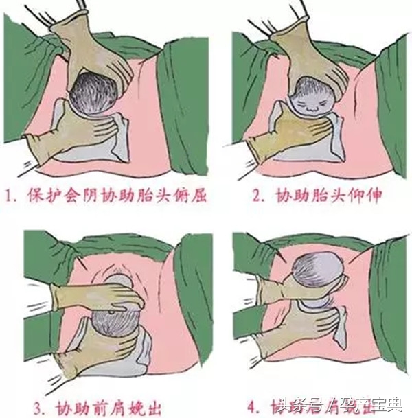 想顺产怎样才能生得快一些呢,顺产如何用力生得快