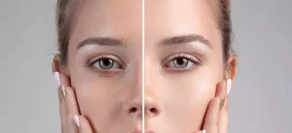 毛孔粗大怎么办用什么护肤品好,毛孔粗大怎样化妆才能遮住毛孔